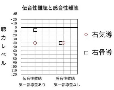 気導骨導